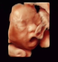 육아로 온통 물든 아들맘:-