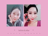 루어는 루어서 떡먹기